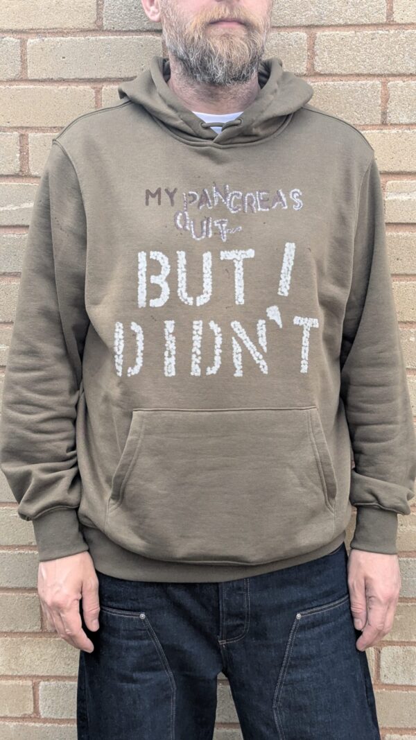 "My Pancreas Quit... But I Didn't" Hoodie
